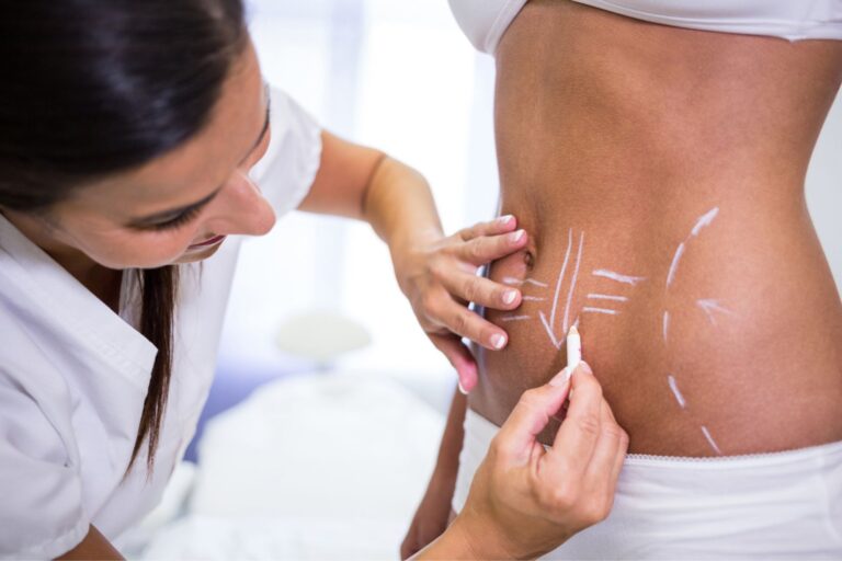 abdomen marking for procedure