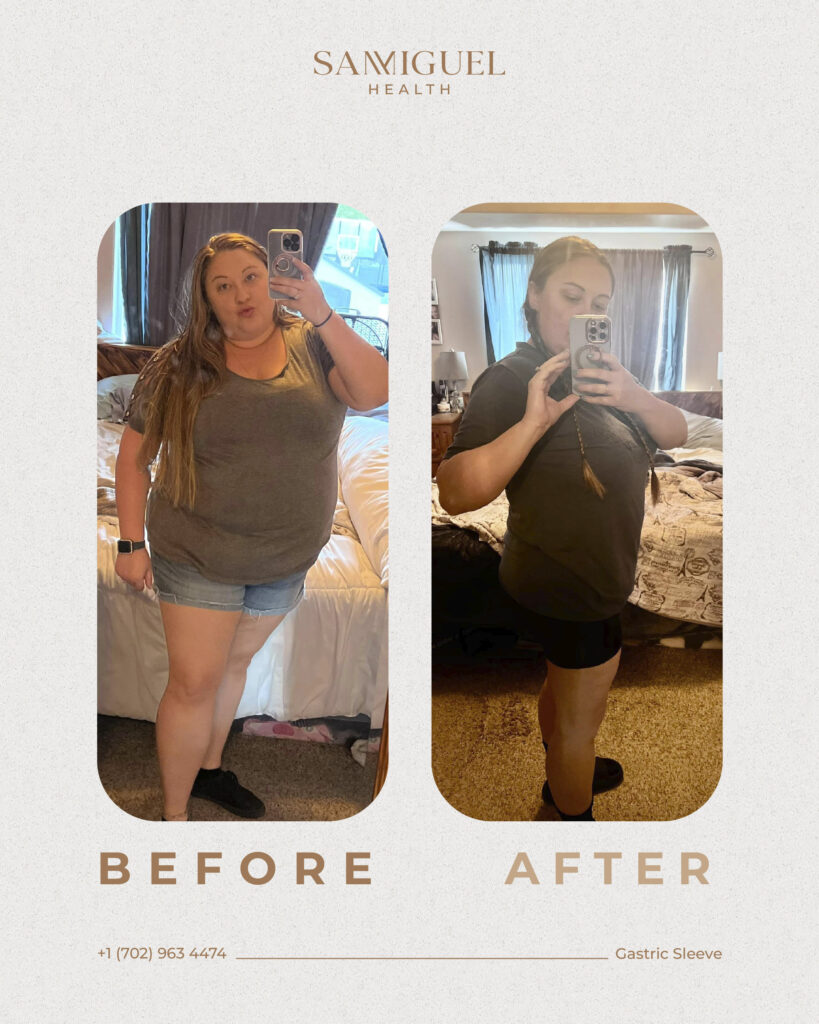 Before _ after 2