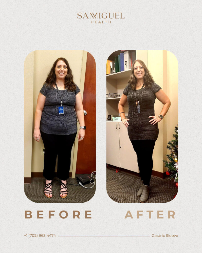 Before _ after 3