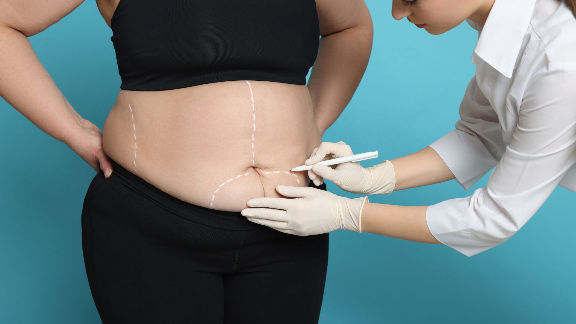 Benefits of bariatric surgery for weight loss and long-term health