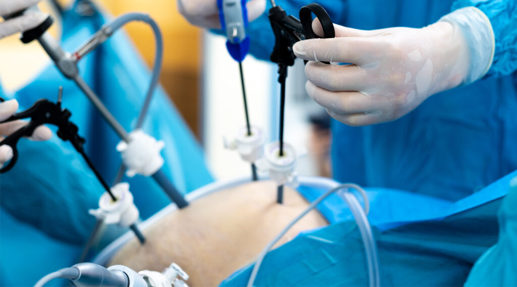 Bariatric surgery impact