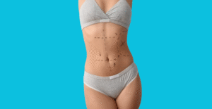 Why More Patients Are Choosing Plastic Surgery in Tijuana Safety, Quality, and Stunning Results